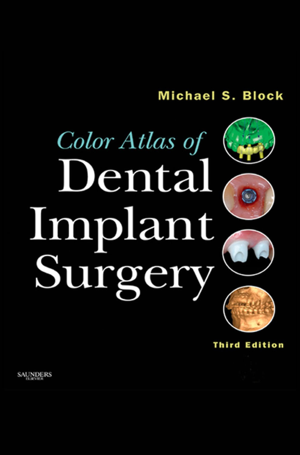 Color Atlas of Dental Implant Surgery by Michael S. Block