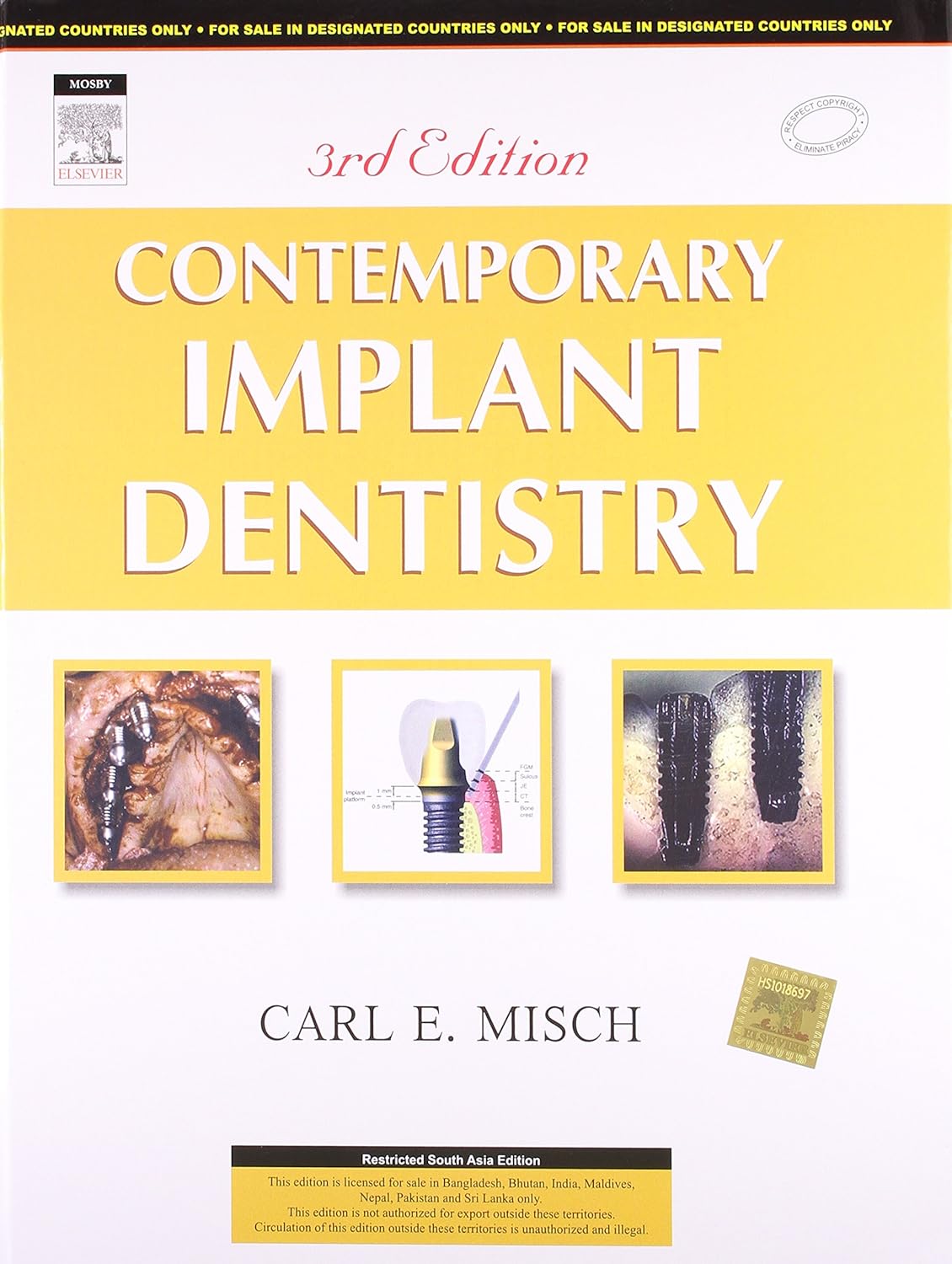 Surgical and Radiologic Anatomy of Oral Implantology