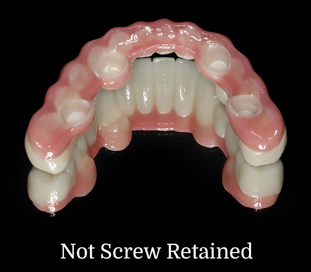 Not Screw Retained