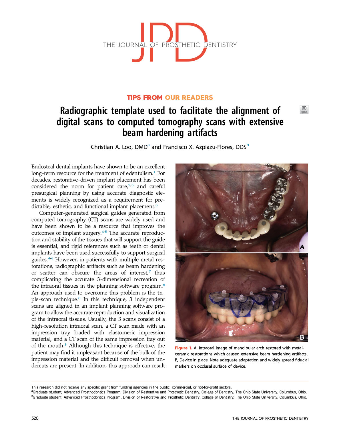 Radiographic-template-used-to-facilitate-the-align