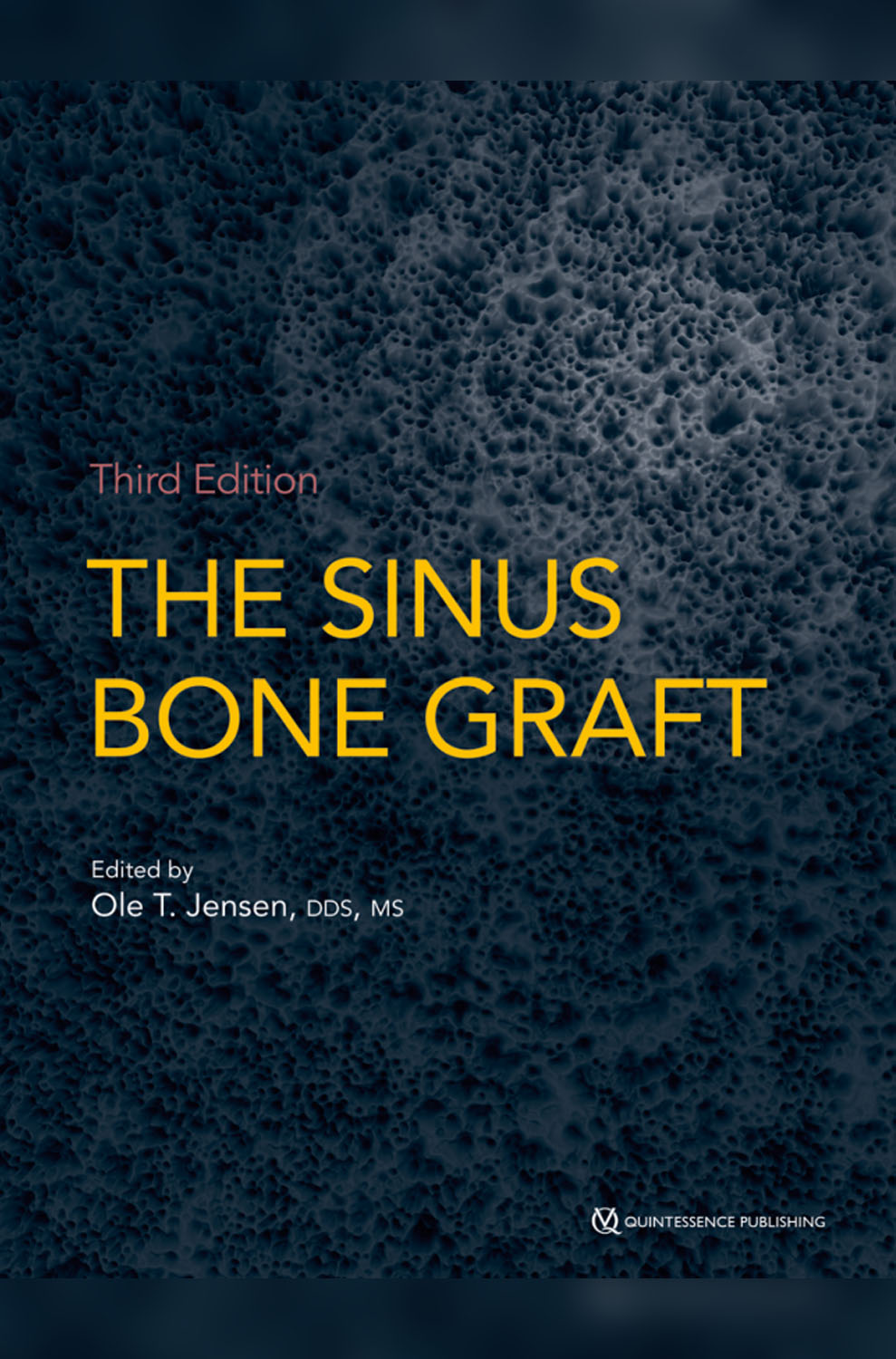 The sinus bone graft Ole T Jensen