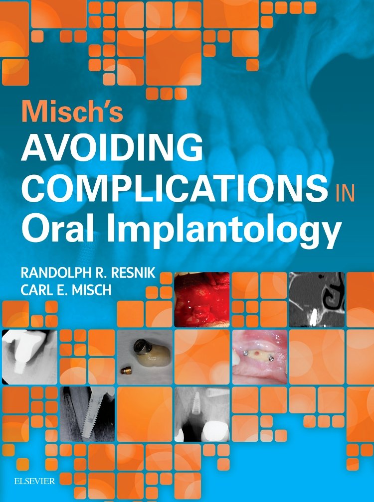 Avoiding complications in Oral Implantology by Randolph Reznik and Carl Misch